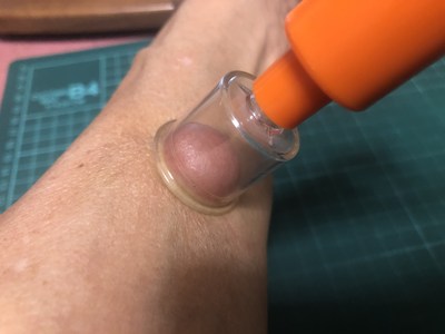 ポイズンリムーバー使用例2